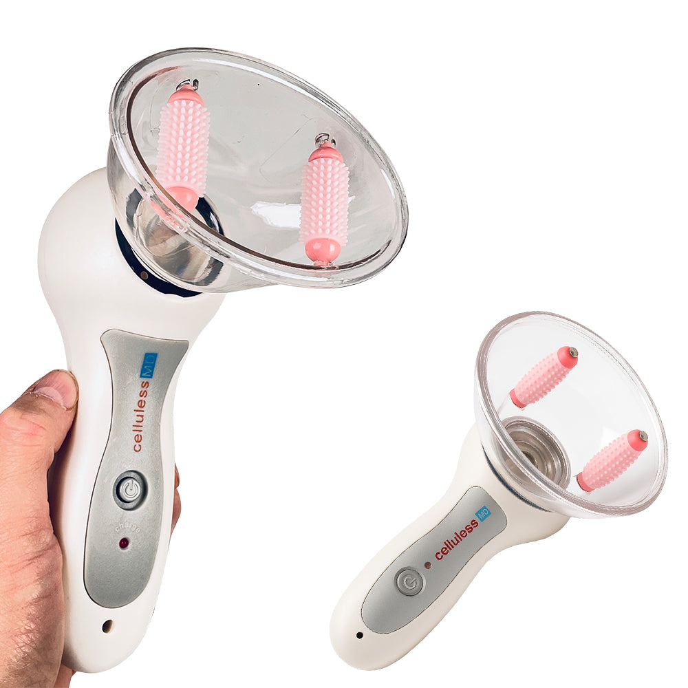 SuckCup – Anti-Cellulite inkl. krem – Få bukt med appelsinhuden